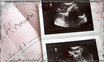 StandUpGirl ultrasound pictures 
