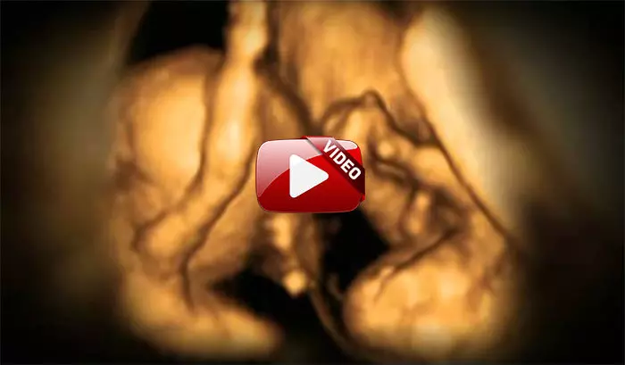 in the womb