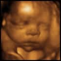3-d ultrasound images of fetus in womb